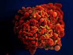 NIH launches clinical trial of three mRNA HIV vaccines