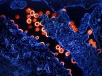 blue cells